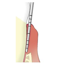 Pocketsonde web