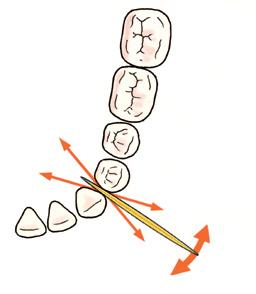 Instructie5 tandenstokers