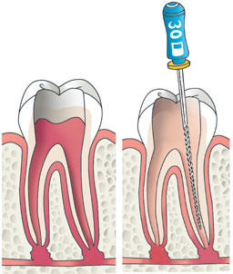 Behandeling 1 en 2 low
